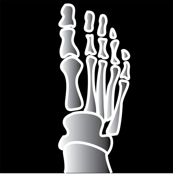Рентгенографія пальців на нозі — стоковий вектор