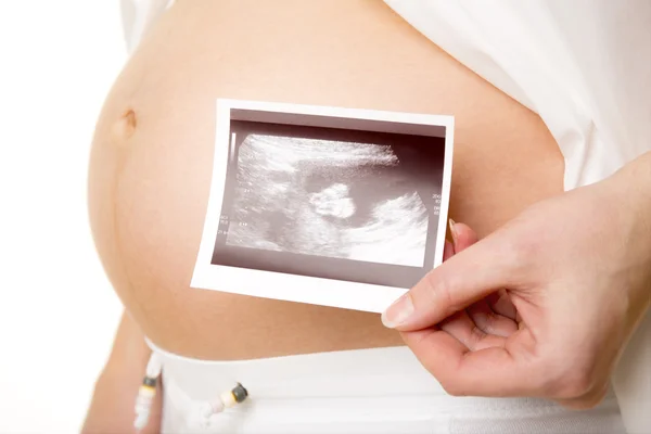 Pregnant with ultrasounds — Stock Photo, Image