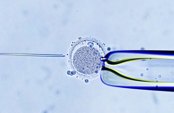 Fertilisation Vitro Injection Sperme Dans Ovule — Photo