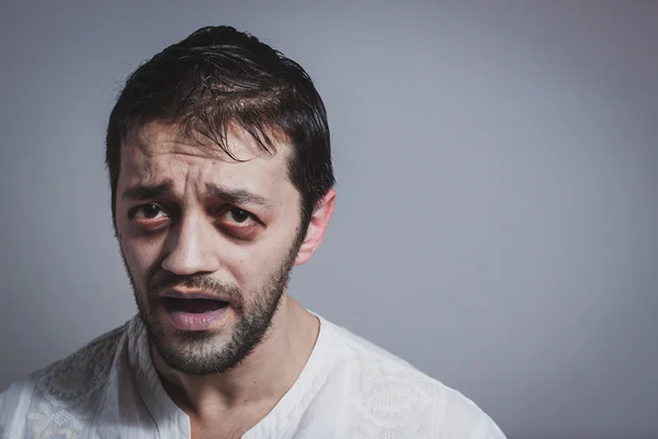 Ugly young bearded man looking sick — Stock Photo, Image