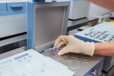 Üreme tıbbının merkezinde dişi bir yumurtayla çalışmak. Yumurtanın tıbbi muayenehanede yapay döllenmesi. Tıbbi bir cihazda dişi yumurtaları dondurmak