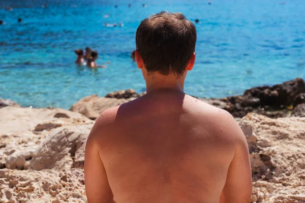 Man Baldness Beach Turkey Guy Shirt Falling Hair Vacation Single — Stock Photo, Image