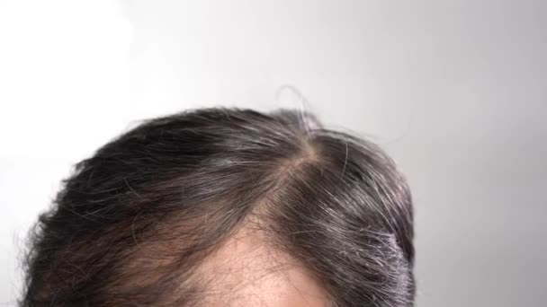 Calvície cabeça masculina close-up no fundo cinza claro — Vídeo de Stock