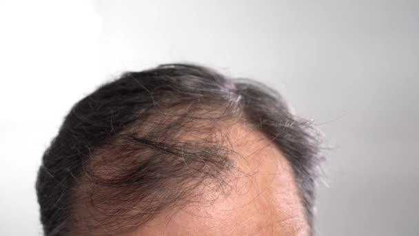 Calvicie cabeza masculina primer plano sobre fondo gris claro — Vídeos de Stock