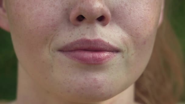 Die Lippen eines rothaarigen Mädchens mit vielen Sommersprossen im Gesicht — Stockvideo