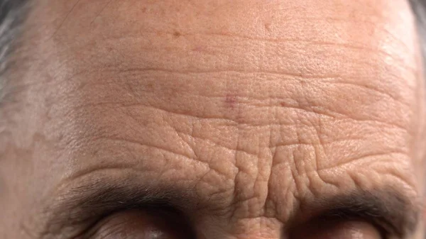 Wrinkled Male Forehead Close Up. Mature Mans Forehead and Wrinkles — Stock Photo, Image