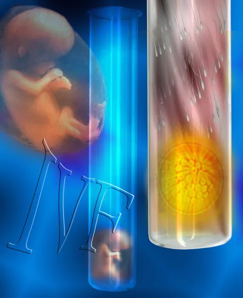 IVF - in vitro-fertilisatie — Stockfoto