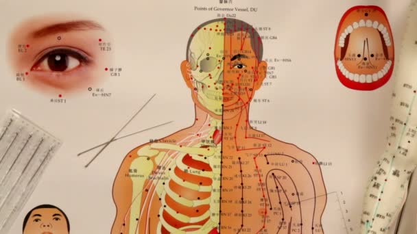 Médecine chinoise - Acupuncture — Video