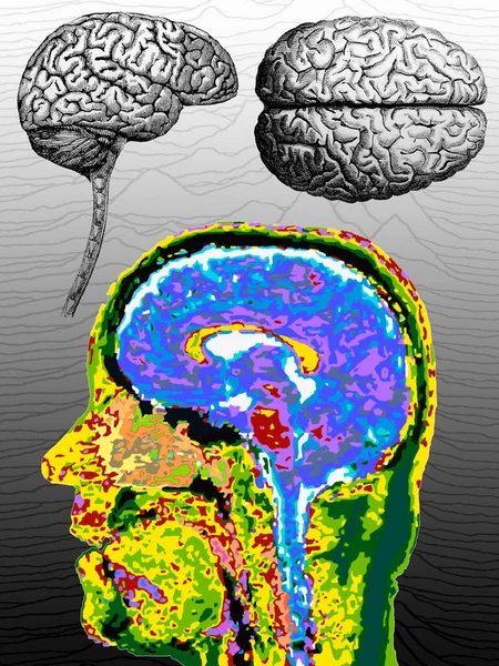 Otak Manusia Ditampilkan Dalam Penampang Warna Palsu Dari Scan — Stok Foto