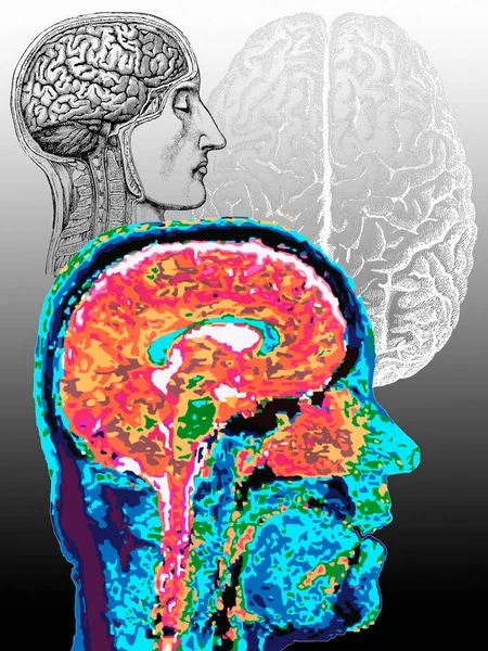 Neuroimaging Brain Imaging Brain Mapping Gebruiken Technieken Zoals Computertomografie Magnetische — Stockfoto