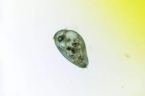 Ciliates Stentor Talált Édesvízi Alatt Fény Mikroszkóp — Stock Fotó