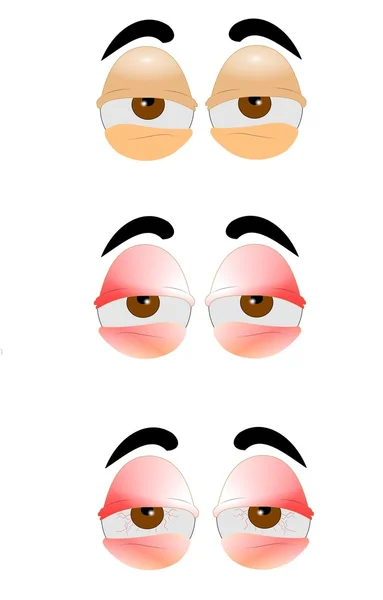 Tired eyes set — Stock Vector