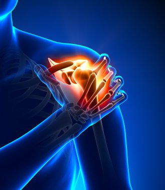 Shoulder pain - detail clipart