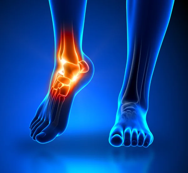 Ankle pain - detail — Stock Photo, Image