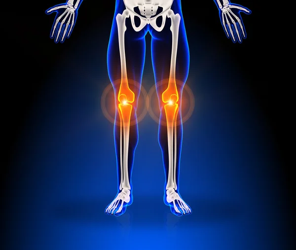 Human knee pain — Stock Photo, Image