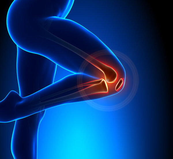 Knee Pain Superior View