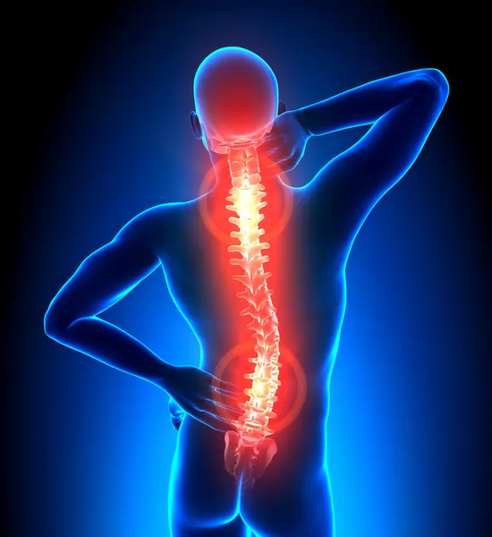 Male Hurt Backbone -Pain — Stock Photo, Image