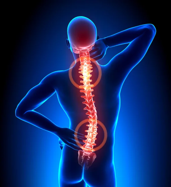 Male Hurt Backbone - Vertebrae Pain — Stock Image Male Hurt Backbone - Vertebrae Pain Stock Picture