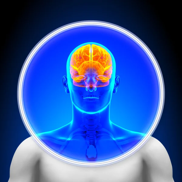 의료용 x 선 검사-뇌 — 스톡 사진