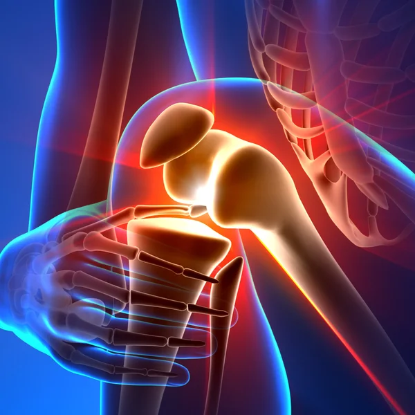 Pijn knie - anatomie stralen — Stockfoto