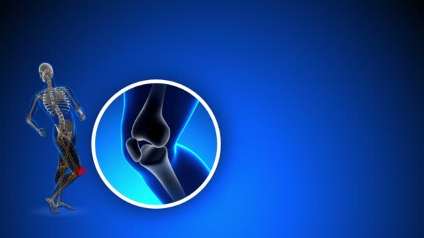 Pain in Knee - Xray concept on blue background — Stock Video