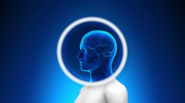 Medical X-Ray Scan - Brain