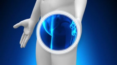 tıbbi x-ray tarama - prostat