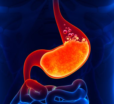 Gastrik asit