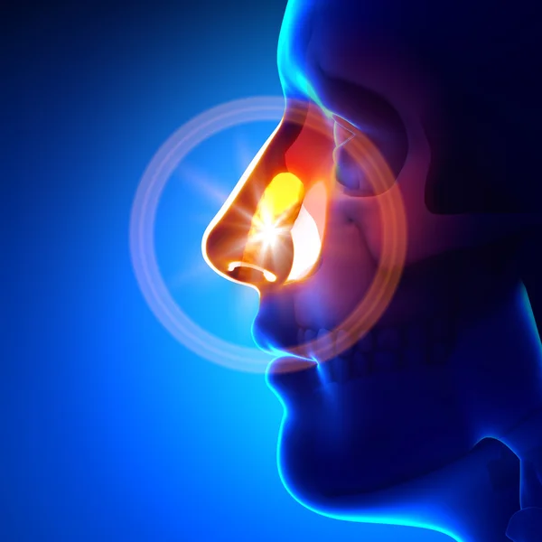 Stuck object in nose — Stock Photo, Image