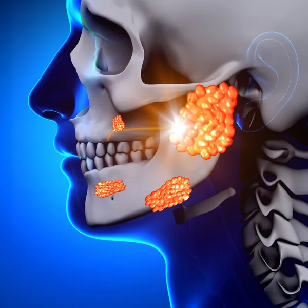 Свинка Parotid Gland - болезнь — стоковое фото