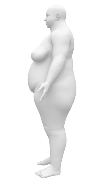 Figura femminile di anatomia obesa - Vista laterale — Foto Stock