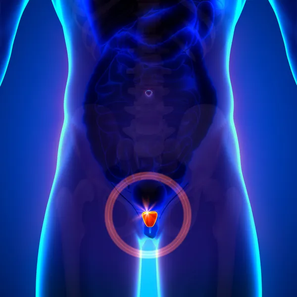 前列腺癌-男性解剖人体器官-x 射线视图 — 图库照片
