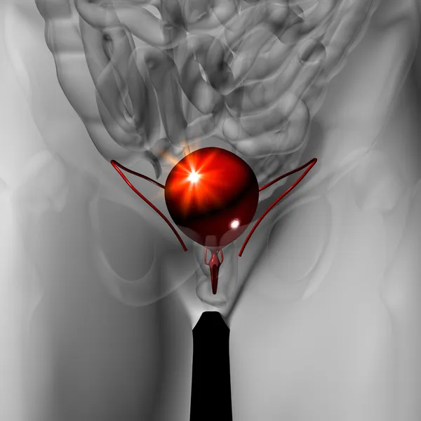 Bladder - Male anatomy of human organs - x-ray view — Stock Photo, Image