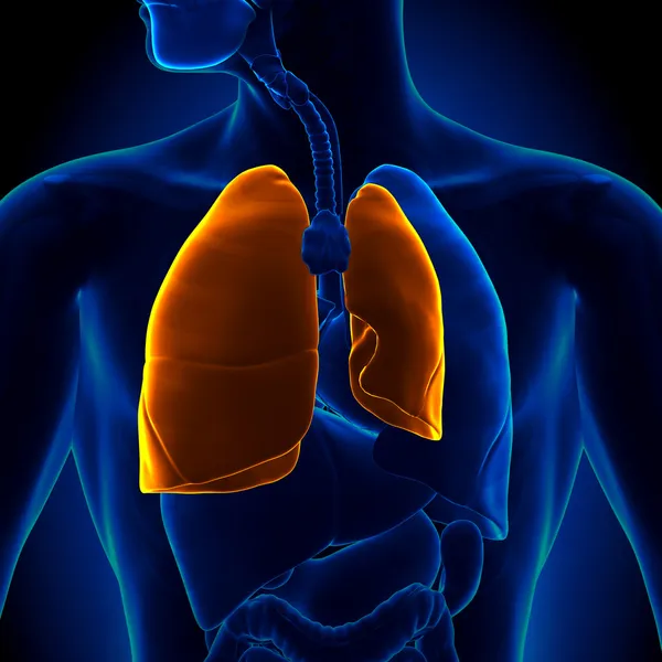 ODMA płucna - upadł płuc — Zdjęcie stockowe