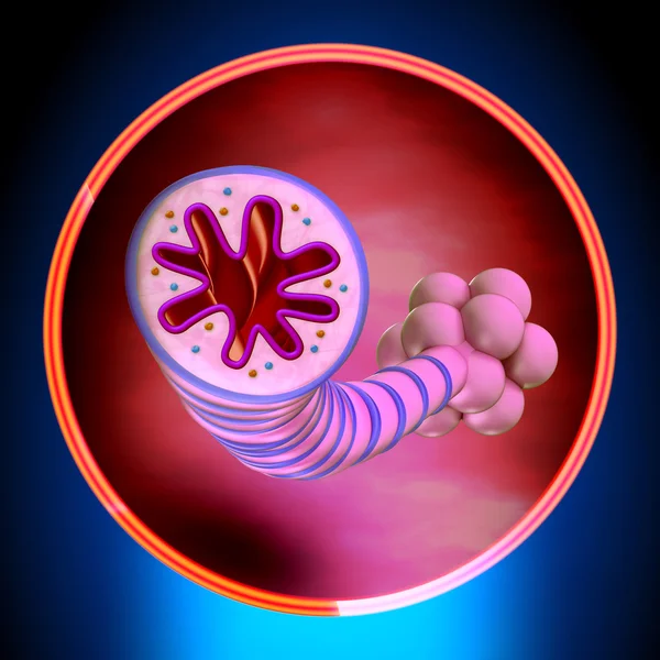 Asma - Malattia infiammatoria cronica — Foto Stock