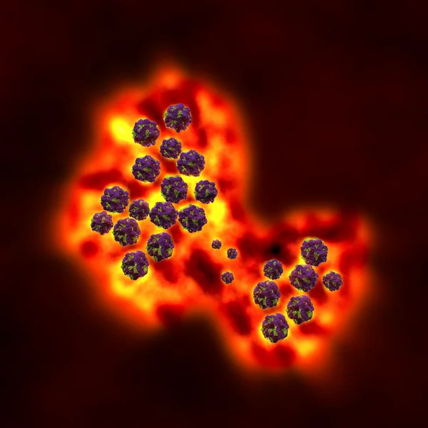 Норовирус — стоковое фото