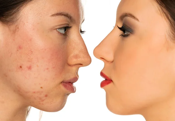 Comparison Portrait Woman Makeup Cosmetics Procedure White Background — Stock Photo, Image