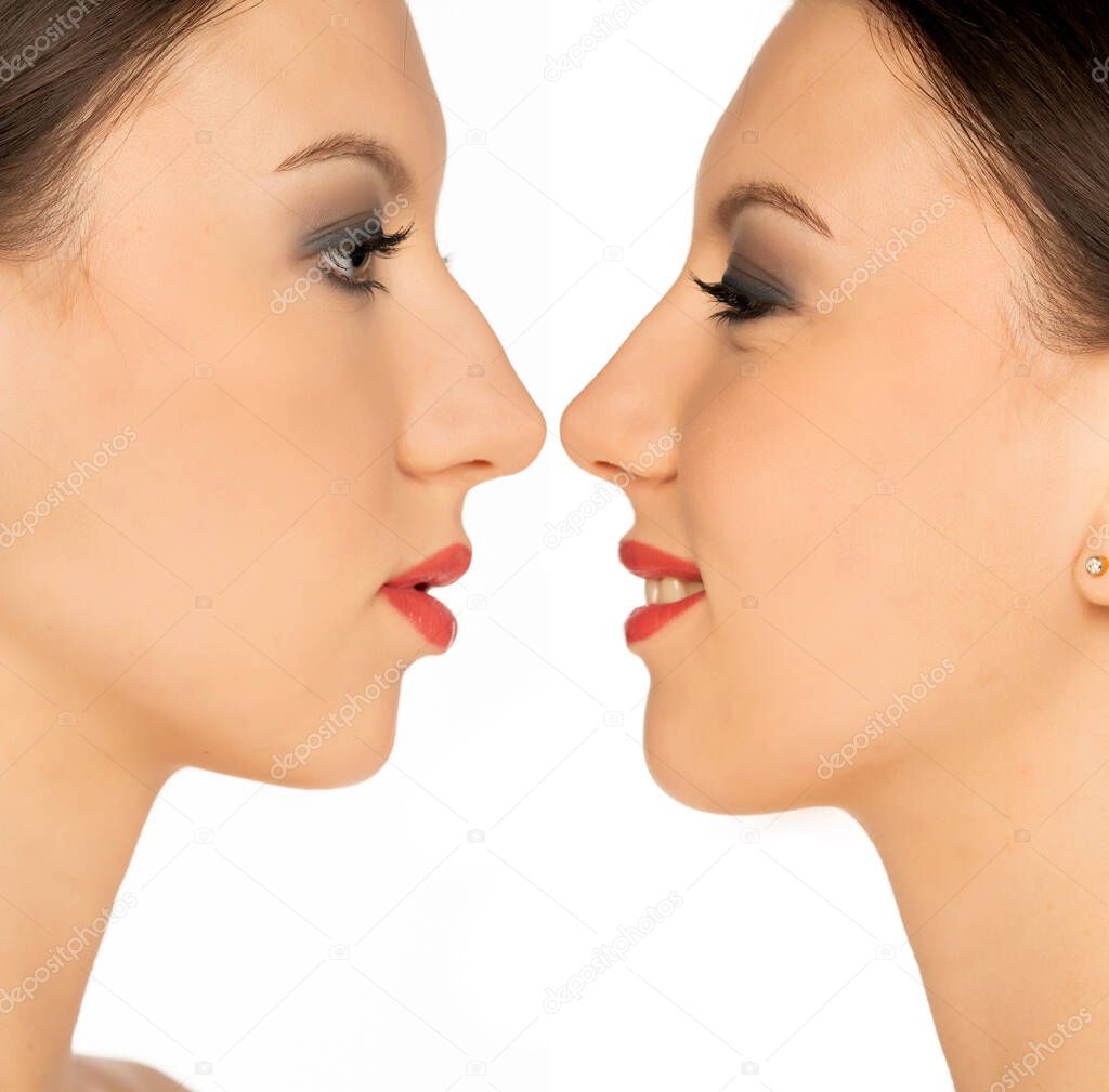 comparison portrait of a young woman, before and after plastic surgery of the nose on a white background