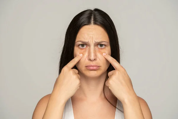 Una Joven Infeliz Toca Sus Ojos Fondo Gris — Foto de Stock