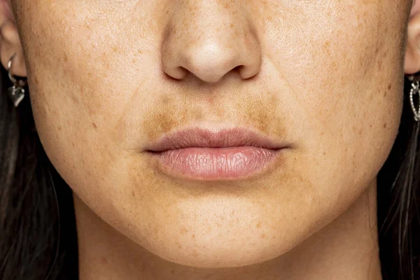 macro shot of a female face with dark skin on the upper lip