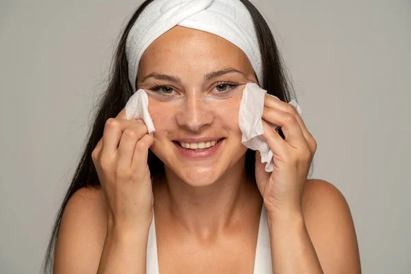 Junge Glückliche Frau Mit Stirnband Reinigt Ihr Gesicht Mit Feuchttüchern — Stockfoto
