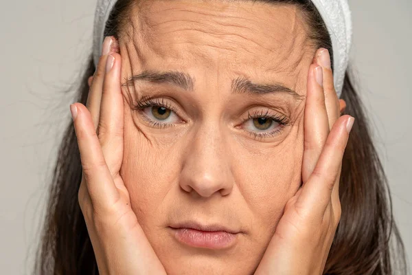 Potret Seorang Wanita Muda Sedih Menunjukkan Keriput Samping Matanya Pada — Stok Foto