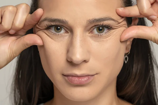 Portrait Young Woman Pinching Her Wrinkles Next Her Eyes Gray — Stock Photo, Image