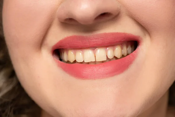 一个有着健康牙齿的漂亮女人的微笑 — 图库照片