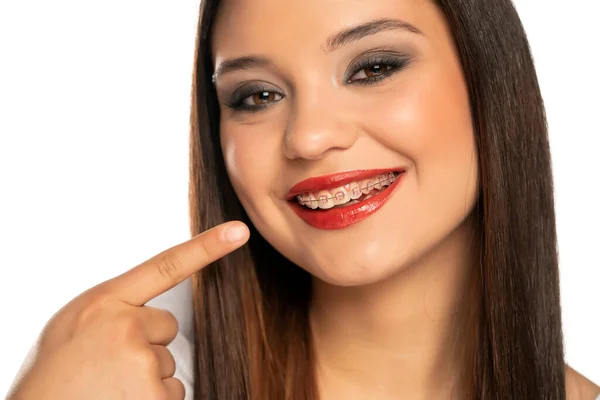 一个年轻的微笑的女人 用白色的背景指着她的假牙 — 图库照片