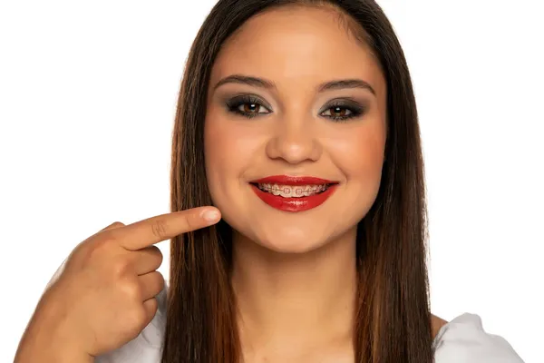 Uma Jovem Mulher Sorrindo Apontando Suas Dentaduras Fundo Branco — Fotografia de Stock