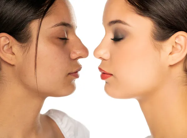 Confronto Del Naso Femminile Prima Dopo Intervento Chirurgia Plastica Fondo — Foto Stock