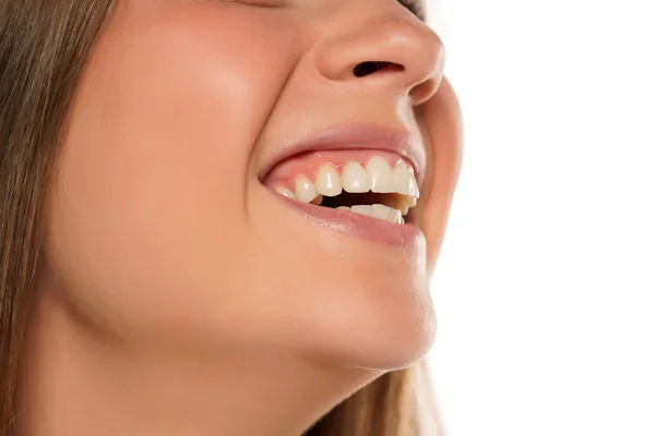 Closeup Young Woman Toothy Smile White Background — Stock Photo, Image