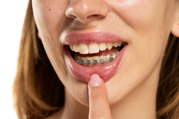 Woman showing her dentures on lower teeth. Close up