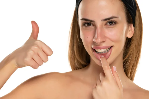 微笑的女人在下牙上露出假牙 在白底上露出大拇指 — 图库照片